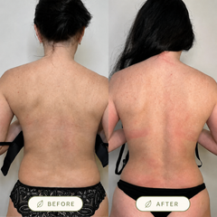 Avenory Posture Corrector