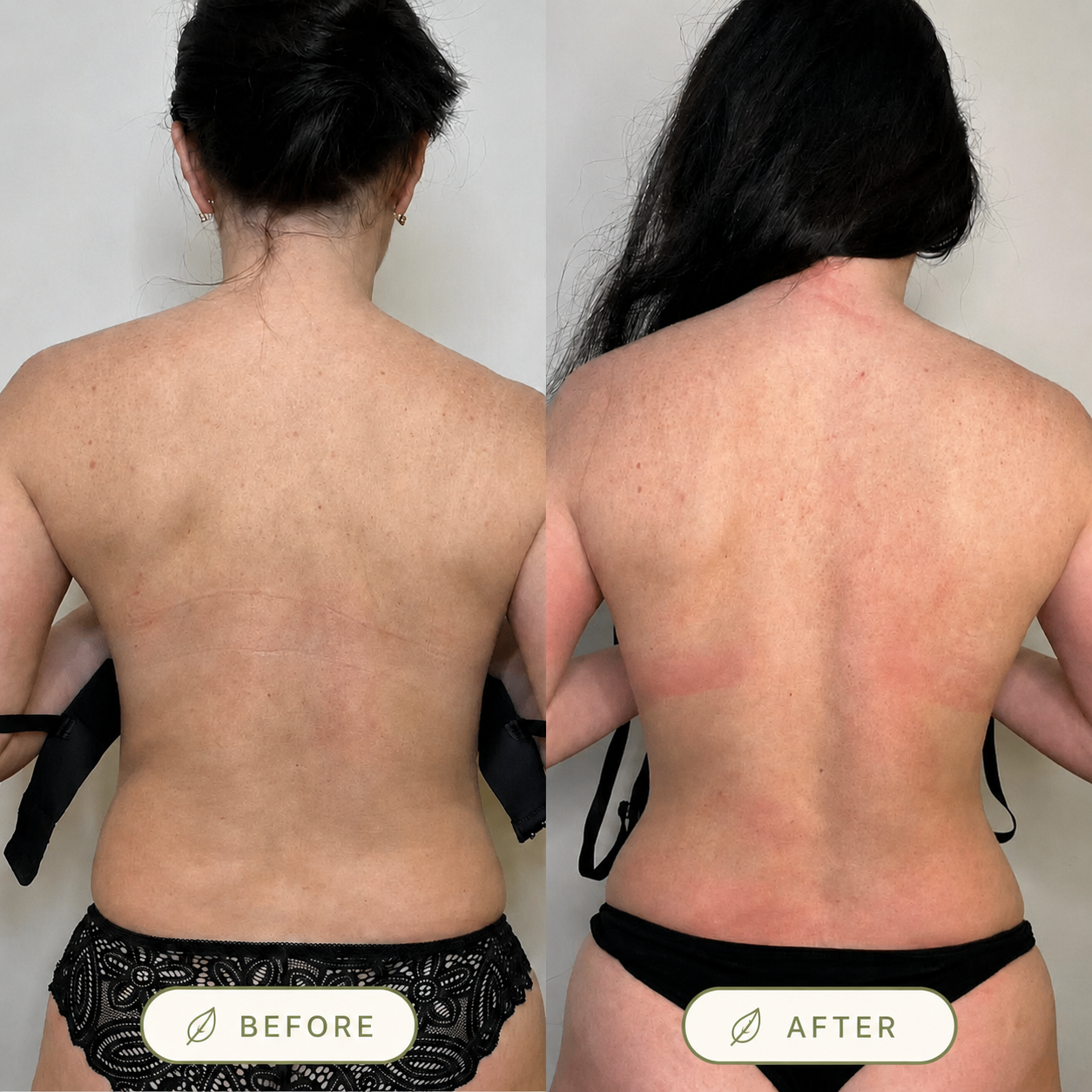 Avenory Posture Corrector