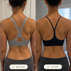 Avenory Posture Corrector