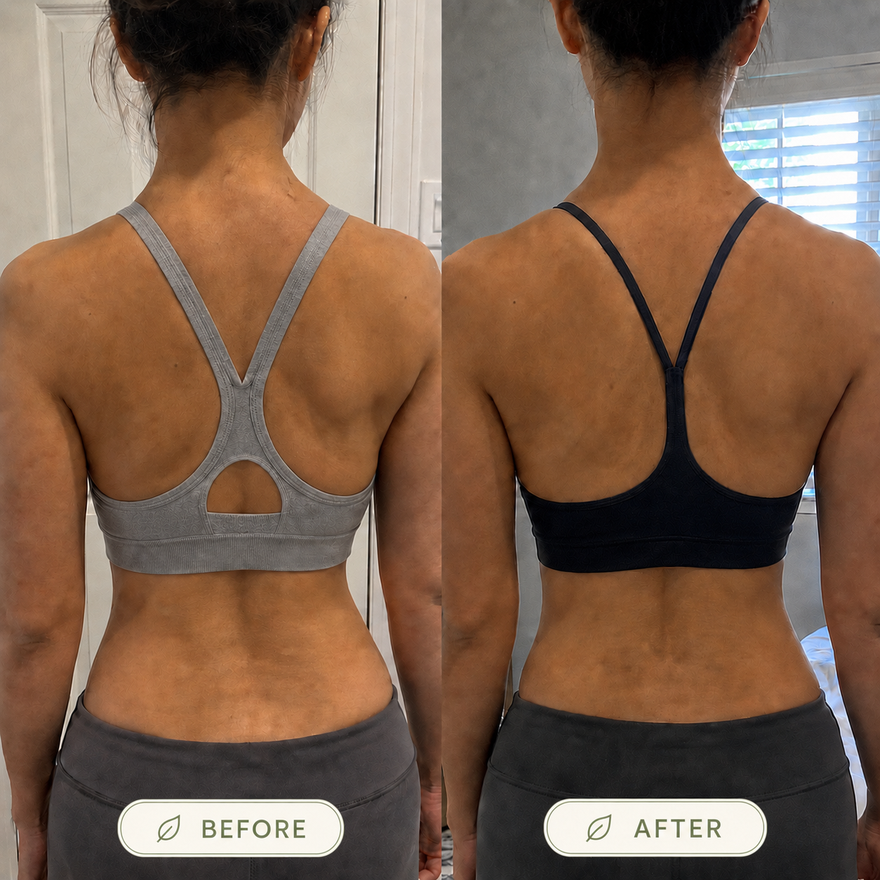 Avenory Posture Corrector